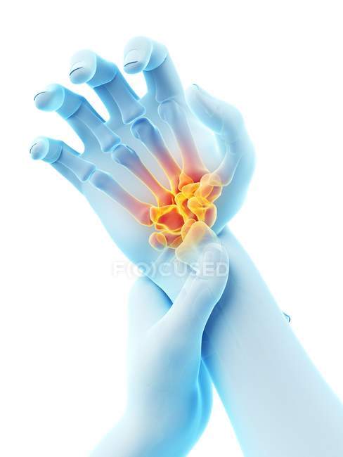 Mãos masculinas com dor de pulso brilhante, ilustração conceitual . — Fotografia de Stock