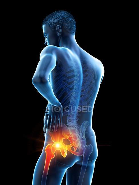 Silhouette maschile astratta con dolore visibile all'anca, illustrazione digitale . — Foto stock