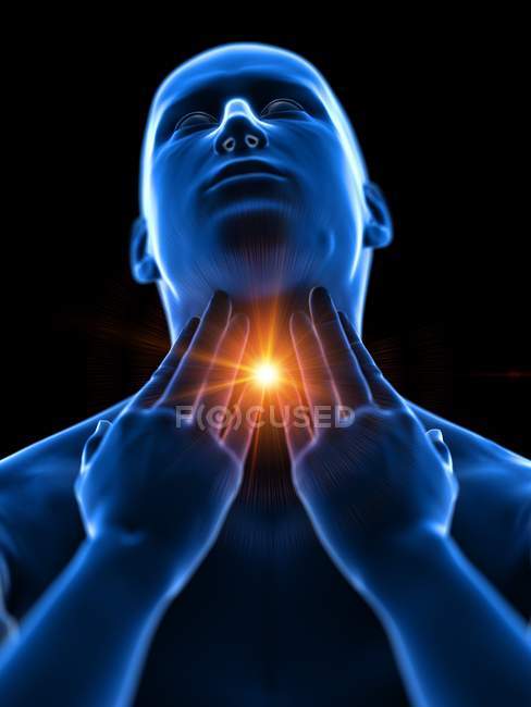 Abstract male body with sore throat on black background, conceptual digital illustration. — Stock Photo
