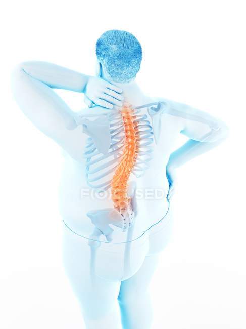 Corpo maschile obeso con mal di schiena in vista ad alto angolo, illustrazione digitale . — Foto stock