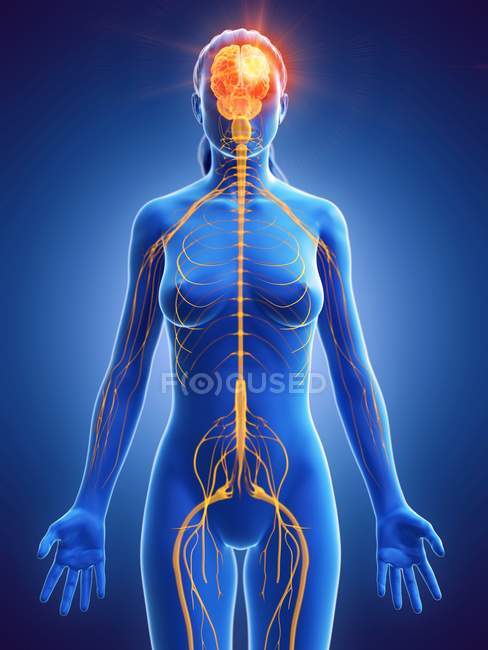 Рак мозку у жіночому тілі, концептуальна комп'ютерна ілюстрація . — стокове фото