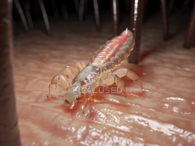 Poux parasites sur la peau de la tête humaine, illustration numérique . — Photo de stock