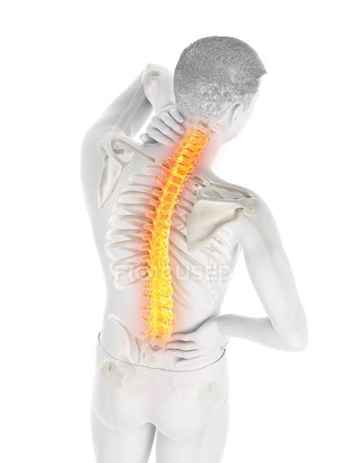 Male silhouette with back pain on white background, conceptual illustration. — Stock Photo