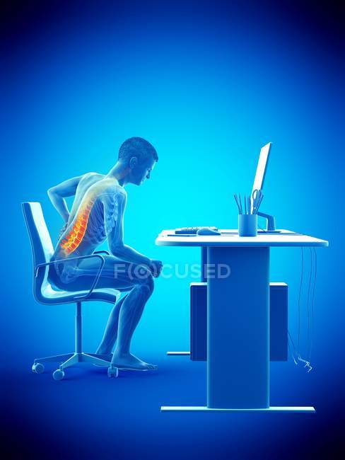 Vue latérale d'un employé de bureau souffrant de maux de dos en raison de sa position assise au bureau, illustration conceptuelle . — Photo de stock