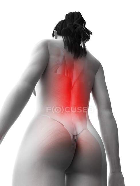 Silueta de cuerpo femenino con dolor de espalda en vista de ángulo bajo, ilustración digital
. - foto de stock