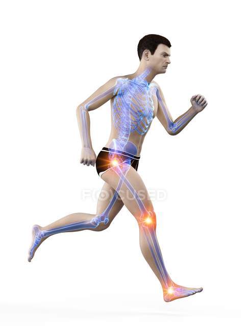 Бігуча людина з точками суглобового болю, концептуальний приклад. — стокове фото