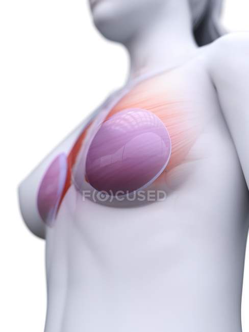 Анатомія молочних імплантатів в жіночому тілі 3d модель, цифрове зображення. — Stock Photo