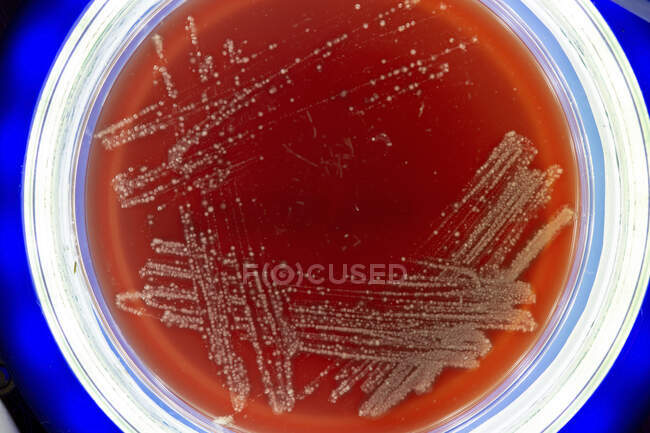 Bakterien auf Petrischale. — Stockfoto