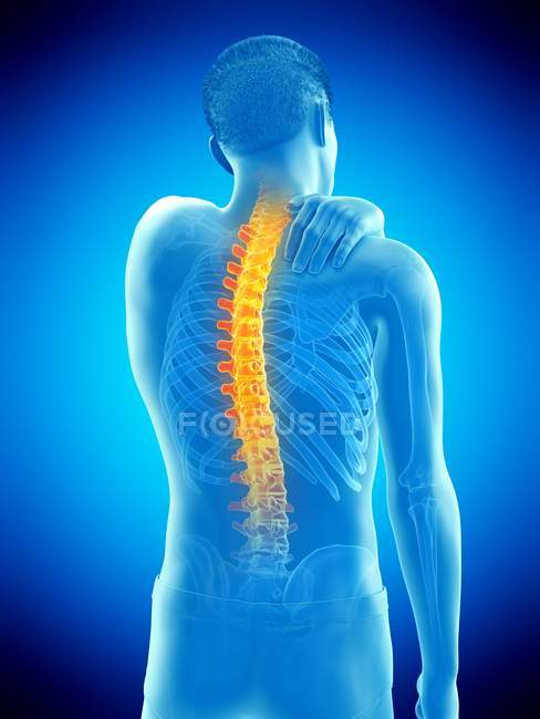 Male silhouette with hand on inflammation of back pain, conceptual illustration. — Stock Photo