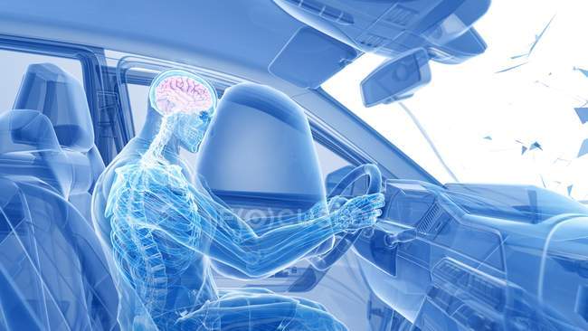 Illustrazione a raggi X del rischio di lesioni cerebrali mentre testa a testa incidente d'auto, opere d'arte digitali . — Foto stock