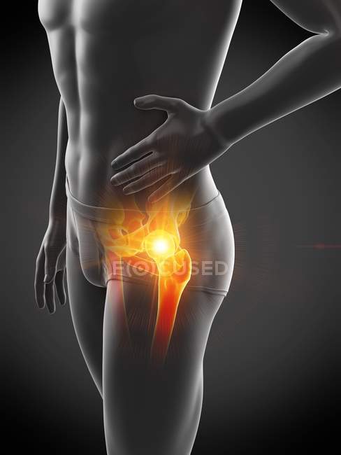 Silhouette masculine avec douleur visible à la hanche, illustration numérique . — Photo de stock