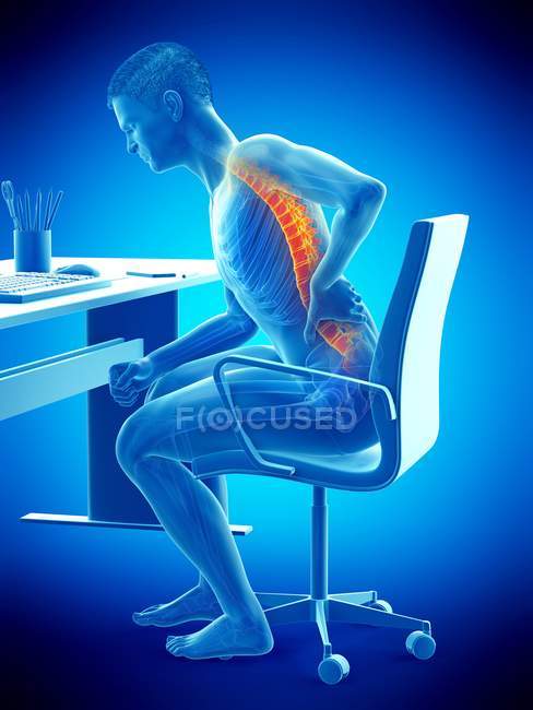 Sentado en el escritorio silueta de trabajador de oficina con dolor de espalda, ilustración conceptual . - foto de stock