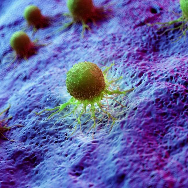 Cellules cancéreuses de couleur verte abstraites sur les tissus, illustration numérique
. — Photo de stock