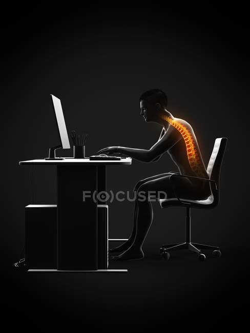 Dor nas costas do trabalhador de escritório sentado e trabalhando na mesa, ilustração conceitual . — Fotografia de Stock