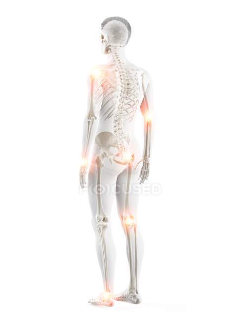 Людське тіло з точками болю в суглобах, концептуальна ілюстрація . — стокове фото
