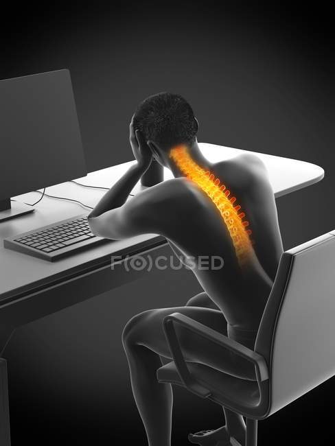 Trabalhador de escritório estressado com dor nas costas, ilustração conceitual
. — Fotografia de Stock