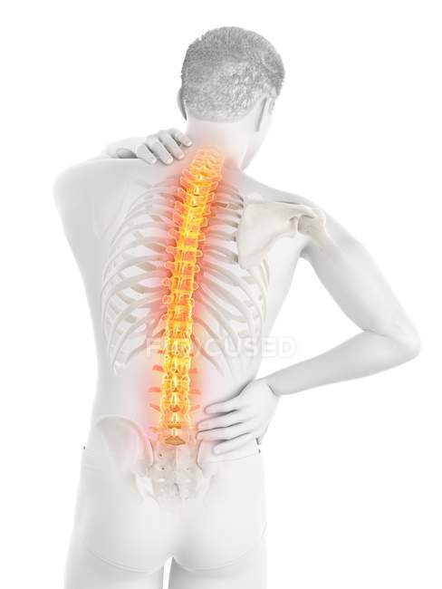 Male silhouette with back pain, conceptual illustration. — Stock Photo
