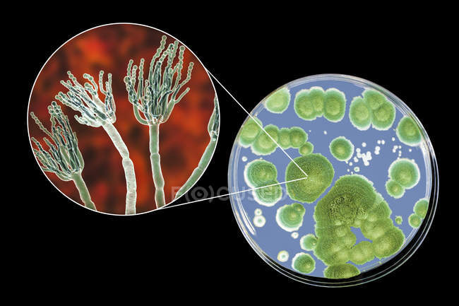 Colonie di funghi Penicillium coltivati su Sabouraud Destrosio Agar e illustrazione digitale della morfologia fungina
. — Foto stock