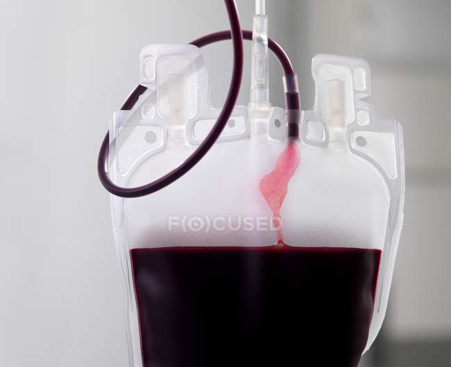 Кров донора розділяється на складові частини мішка.. — стокове фото