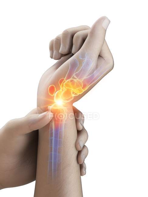Mains humaines abstraites avec douleur au poignet, illustration conceptuelle . — Photo de stock