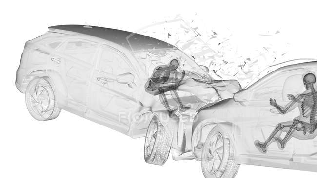 Illustration par rayons X du risque de blessure lors d'un accident de voiture frontal, illustration numérique . — Photo de stock
