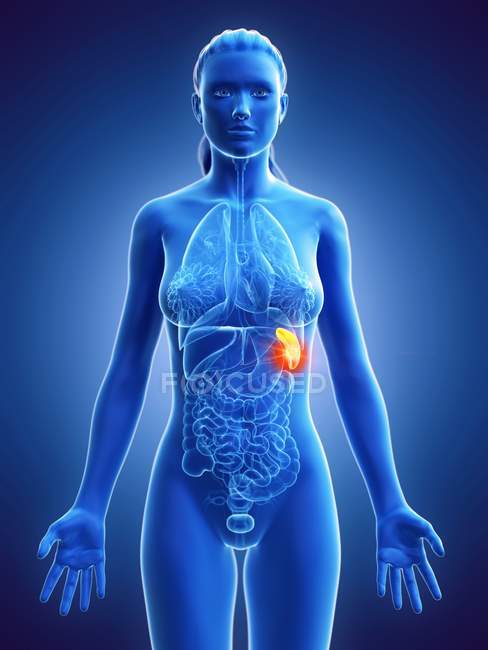 Cancro della milza nel corpo femminile, illustrazione del computer . — Foto stock