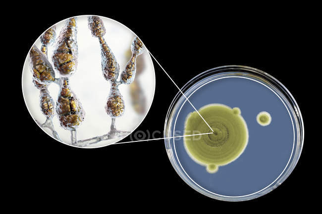 Illustrazione digitale della morfologia fungina del fungo allergenico filamentoso Alternaria alternata e fotografia di colonie fungine su Sabouraud Destrosio Agar
. — Foto stock