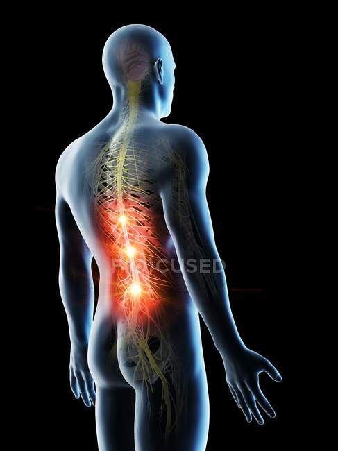 Konzeptionelle digitale Illustration von Rückenschmerzen in transparenter menschlicher Silhouette. — Stockfoto