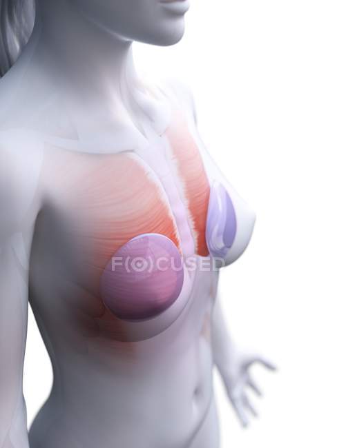 Анатомія грудних імплантатів у жіночому організмі 3d модель, цифрова ілюстрація . — стокове фото