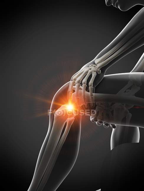 Cuerpo masculino abstracto con dolor visible de rodilla, ilustración digital . - foto de stock