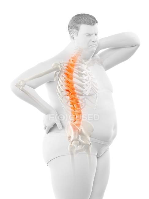 Ожирення чоловічого тіла з болем у спині, концептуальна ілюстрація . — стокове фото