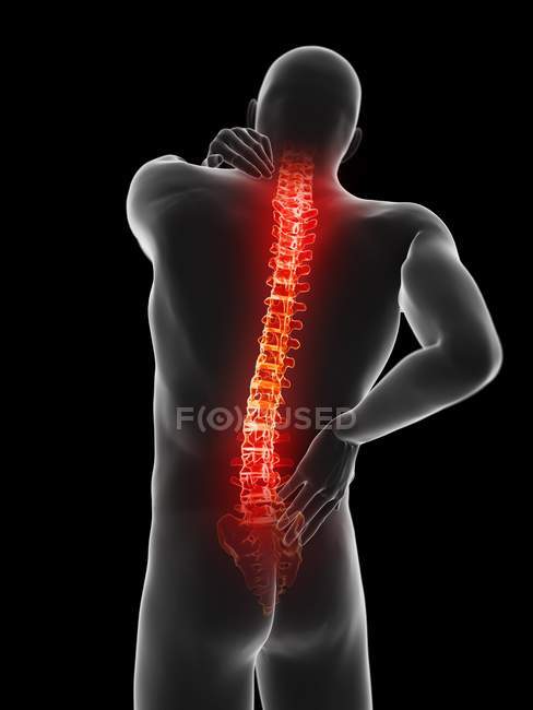 Cuerpo masculino con dolor de espalda sobre fondo negro, ilustración digital . - foto de stock