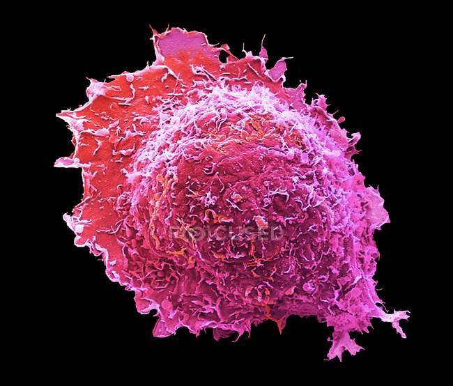 Цветной сканирующий электронный микрограф костной клетки остеоцита . — стоковое фото