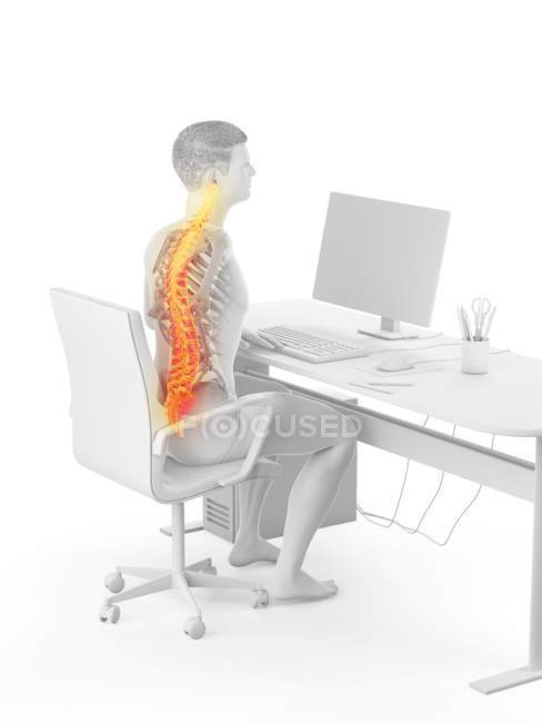 Oficinista silueta sentado en el escritorio con dolor de espalda, ilustración conceptual . - foto de stock