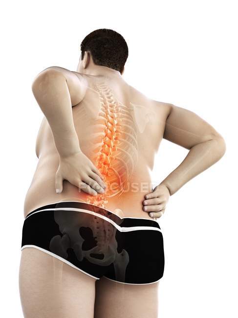 Corpo maschile obeso con mal di schiena in vista a basso angolo, illustrazione digitale
. — Foto stock
