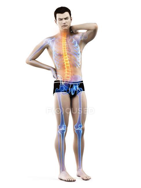 Corpo maschile con mal di schiena su sfondo bianco, illustrazione concettuale . — Foto stock