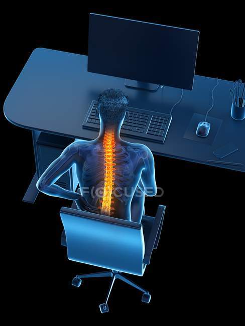 Trabajador de oficina con dolor de espalda debido a sentarse en vista de ángulo alto, ilustración digital . - foto de stock