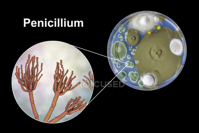 Colonias de hongos Penicillium cultivados en Sabouraud Dextrosa Agar e ilustración digital de la morfología fúngica . - foto de stock