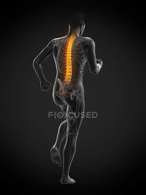 Laufende männliche Silhouette mit Rückenschmerzen, konzeptionelle Illustration. — Stockfoto