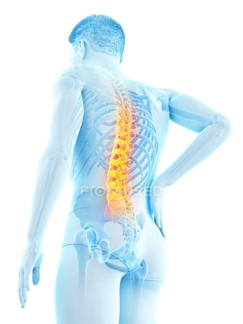 Silueta masculina con dolor de espalda en ángulo bajo, ilustración conceptual . - foto de stock