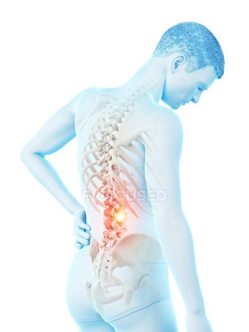 Männliche Silhouette mit Rückenschmerzen auf weißem Hintergrund, konzeptionelle Illustration. — Stockfoto