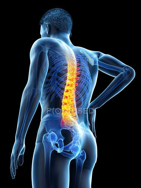 Silhueta masculina com dor nas costas em visão de baixo ângulo, ilustração conceitual . — Fotografia de Stock