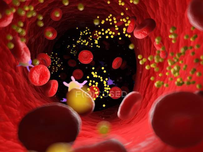 Grasa en las células sanguíneas que bloquean los vasos sanguíneos, ilustración digital . - foto de stock