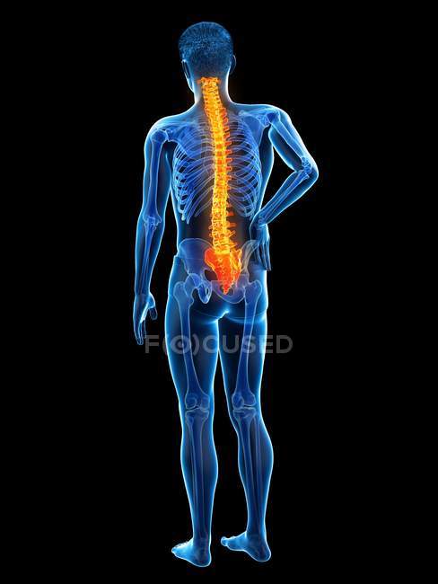 Мужской силуэт с болью в спине на черном фоне, концептуальная иллюстрация . — стоковое фото