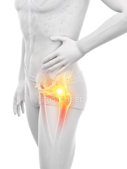 Silhouette del corpo maschile con dolore visibile all'anca, illustrazione digitale . — Foto stock