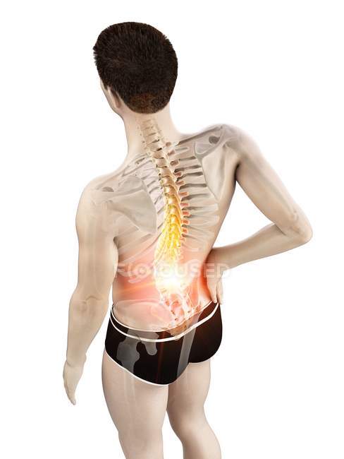 Cuerpo masculino con dolor de espalda en vista de ángulo alto, ilustración conceptual . - foto de stock
