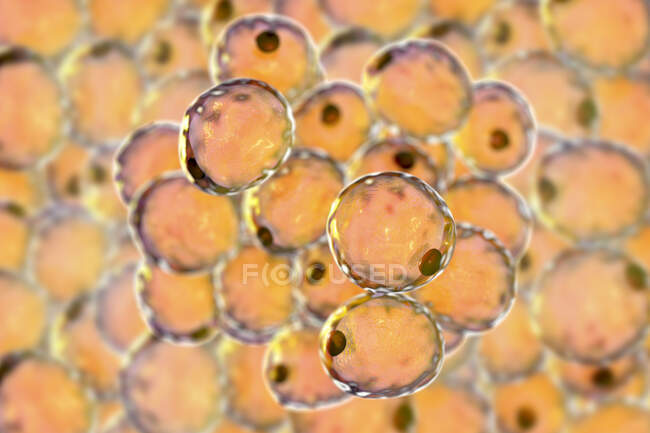 Células de grasa, ilustración informática - foto de stock