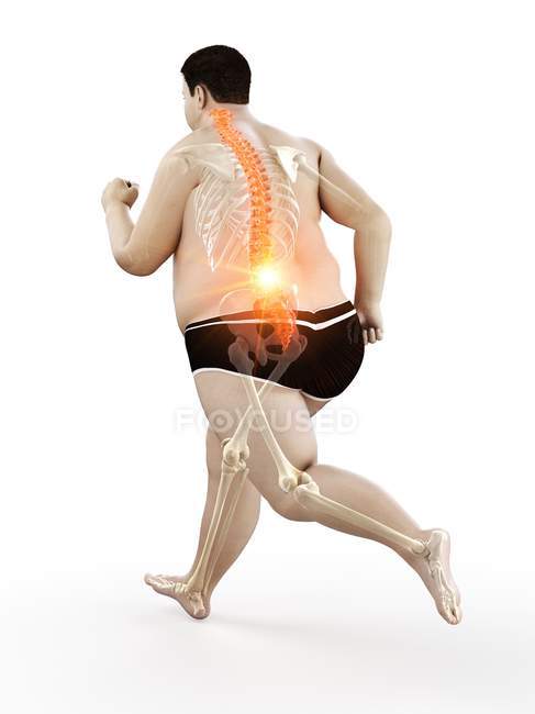 Ожирение тела бегуна с болью в спине, концептуальная иллюстрация . — стоковое фото