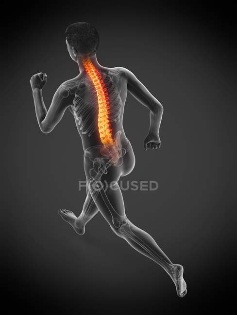 Silhouette of running athlete with back pain, conceptual illustration. — Stock Photo