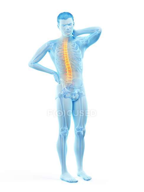 Vista frontale del corpo maschile con mal di schiena, illustrazione concettuale . — Foto stock